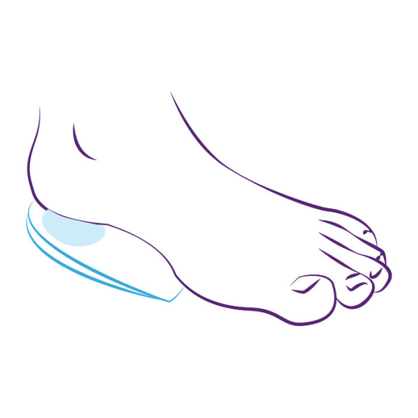 Подпяточники ортопедические силиконовые СТ-40  Trives