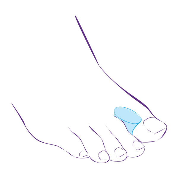 Межпальцевая перегородка СТ-31  Trives