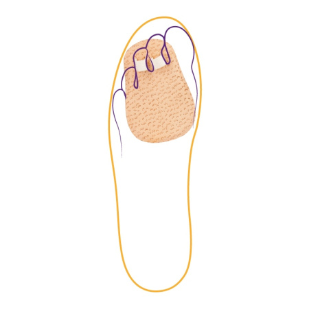 Корректор двух пальцев СТ-222  Trives