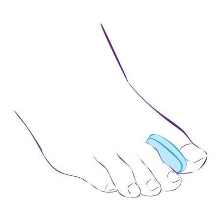 Межпальцевый вкладыш СТ-32  Trives Межпальцевый вкладыш СТ-32  Trives